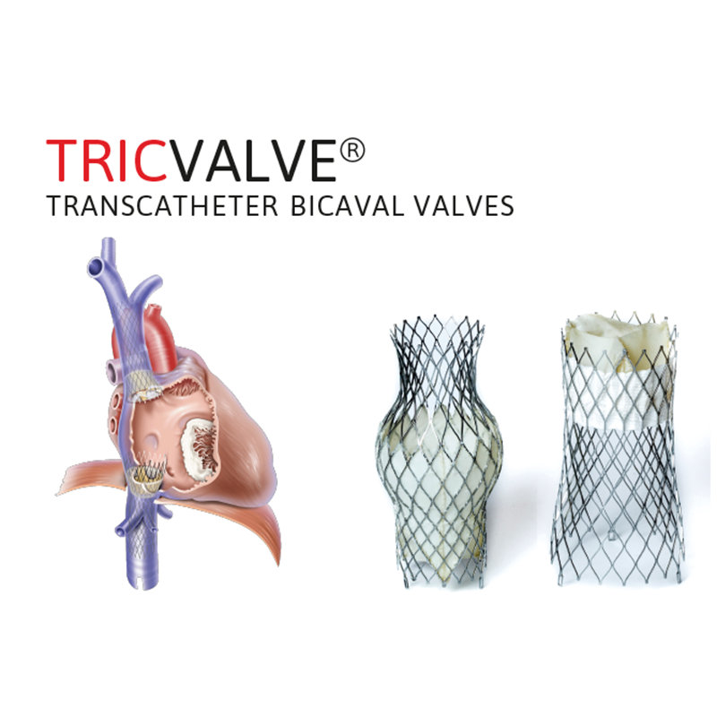 TricValve®