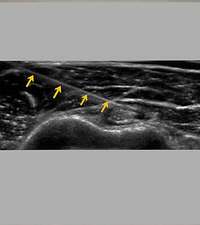 Untitled design (8)_edited.jpg