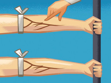 Shkencë: Zbulimi i qarkullimit të gjakut