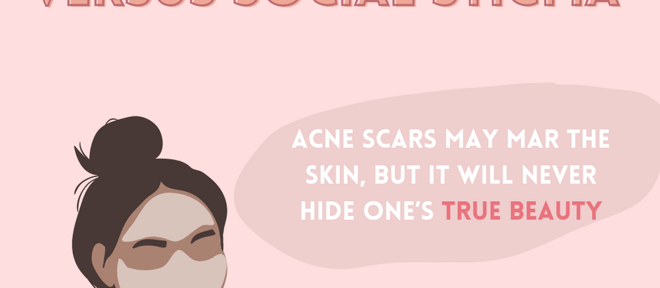 Acne Positivity versus Social Stigma