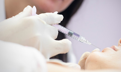 Tecnica de aplicacion Ácido Hialurónico en labios