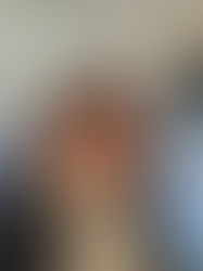 Implications of Introducing Under-16 social media bans