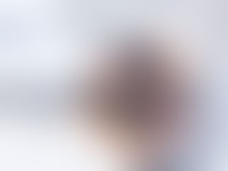 What is a Carbon Laser Facial?