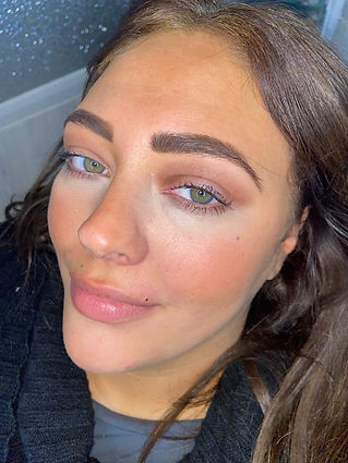 freckling.jpeg
