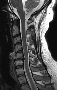 Camelback Radiology | Radiology Reads, Teleradiology, Second Opinion Services | Neuroradiological, Acute Trauma, Musculoskeletal, Body & Personal Injury
