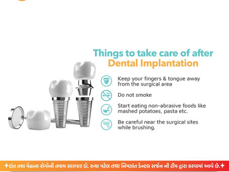 🦷 Things to Take Care of After Dental Implantation 🦷