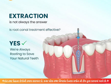 🦷✨ EXTRACTION is not always the answer!At Swaminarayan Dental Clinic, we believe in saving your natural teeth whenever possible. 💪❤️Yes, Root Canal Treatment is effective, safe