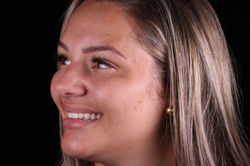 Sorriso lado esquerdo