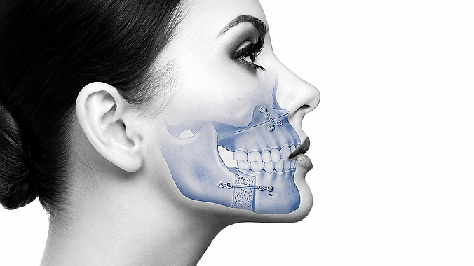 Bruxism si ATM servicii de terapie miofunctionala orofaciala adulti.png