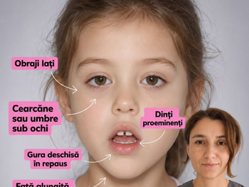 Cearcănele la copii și oboseală cronică: de ce gura deschisă le strică somnul