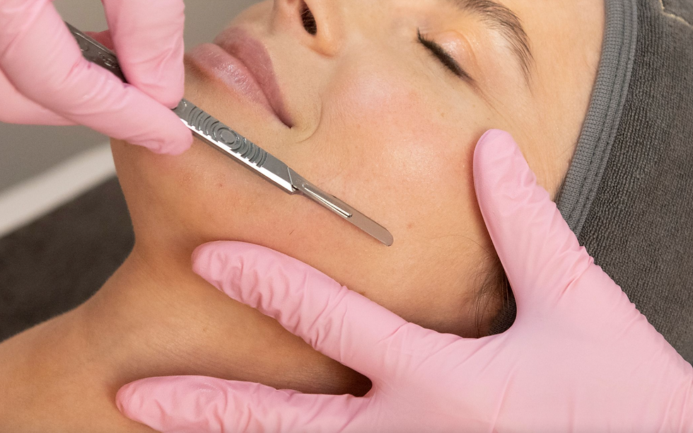 IMS Dermaplaning Header Photo.png
