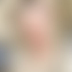 6 products that helped heal my sensitised skin