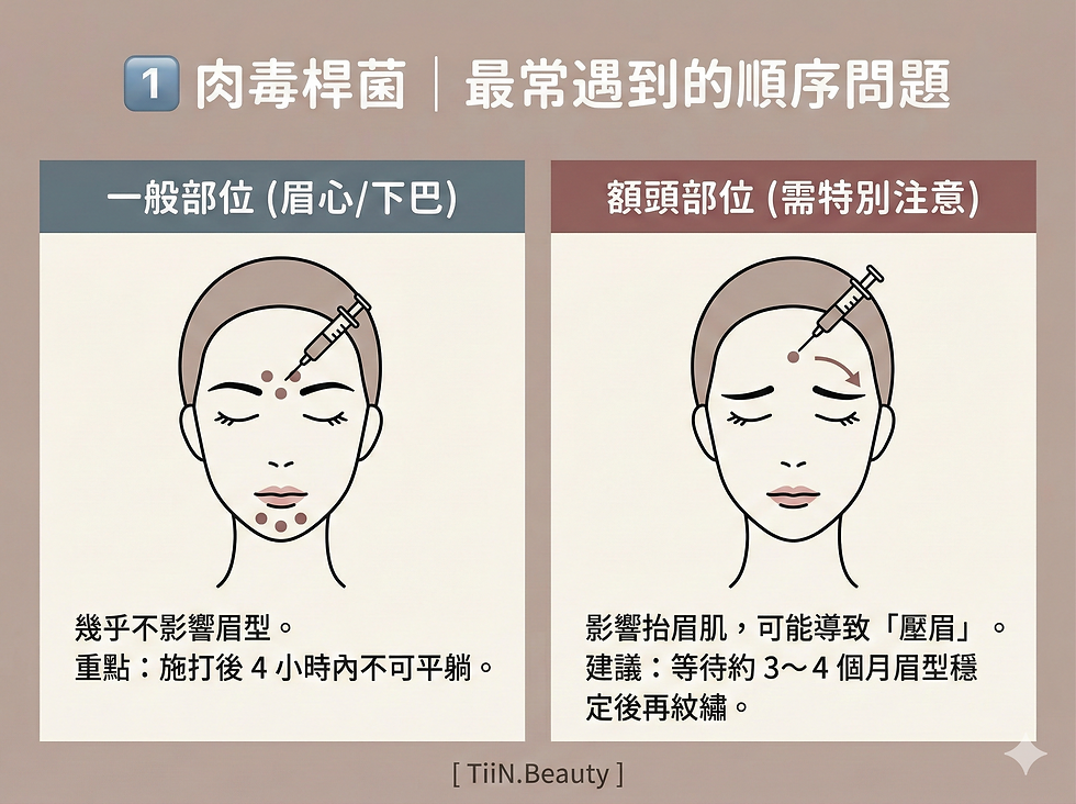 肉毒桿菌施打順序示意圖,分一般部位與額頭部位兩欄,畫出臉部與注射針頭,文字提示眉心/下巴與額頭需注意時機。