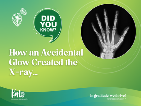 A graphic for Kalo Clinical Research with a green and teal gradient background. The left side features a "Did You Know?" speech bubble and large white text that reads: "How an Accidental Glow Created the X-ray..." On the right, a circular frame showcases a black and white X-ray of a human hand. The Kalo Clinical Research logo is in the bottom left corner, and the brand tagline, "In gratitude, we thrive!", is in the bottom right.