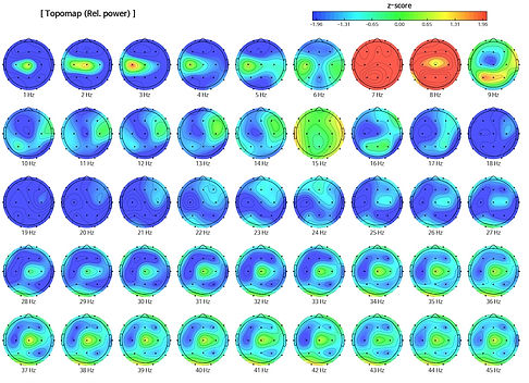 Topomap EEG