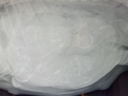 Cannella's X-Ray