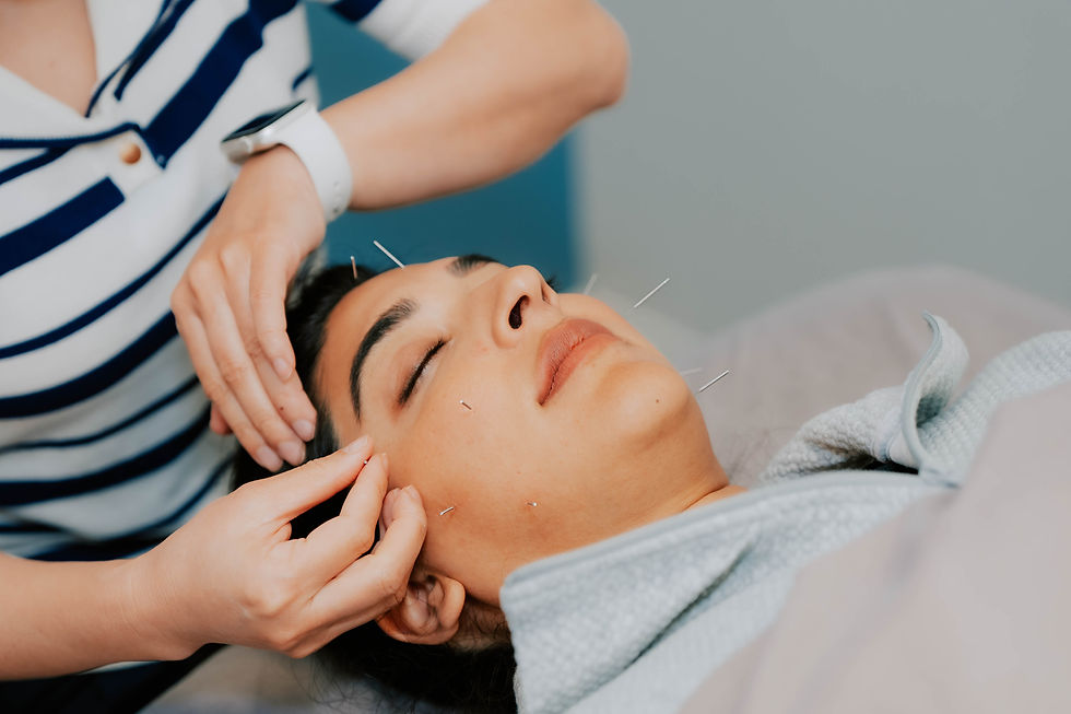 A relaxed woman receives acupuncture on her face with several needles placed gently