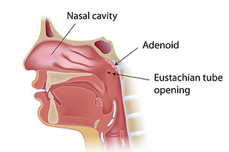 Adenoids_INSIDE-PAGE_dreamstime_xxl_2771