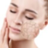 Microdermaplaning.jpeg