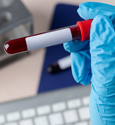surgeon-holding-blood-test_edited.jpg