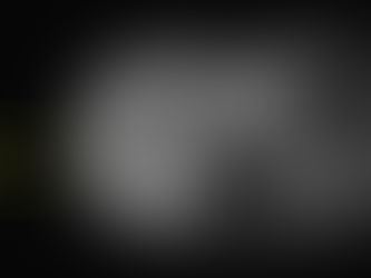 Contraste hepato específico en lesiones hepáticas