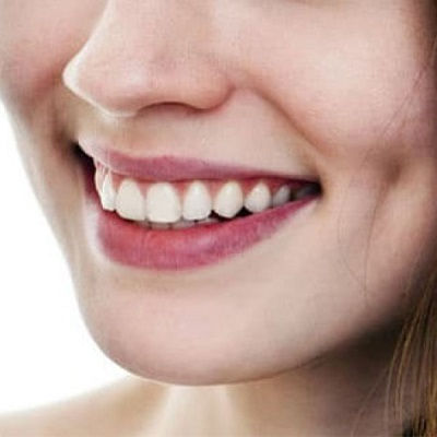 Best Dimple Creation Muscat
