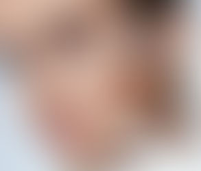 Can Hyalift Injection Improve Acne Scars?