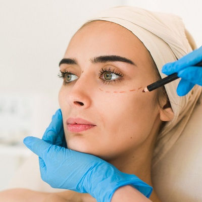 Blepharoplasty in Muscat
