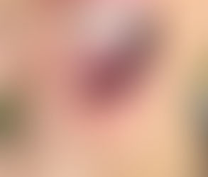 Dental Appliances for Jaw Pain Reduction