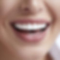 How Dental Veneers Fix Cracked Front Teeth