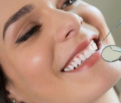 How Long Does Teeth Whitening Last in Dubai?