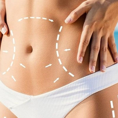 Waist Sculpting in Muscat