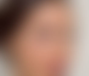 حقن الفيلر للشفتين: أساسيات العناية اللاحقة