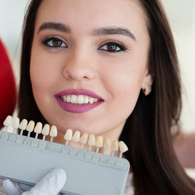 Composite Veneers Dubai