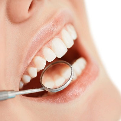 Best SMART – Dental Amalgam Removal in Dubai