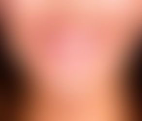 How Digital Smile Design Can Solve Dental Issues with Precision in Dubai