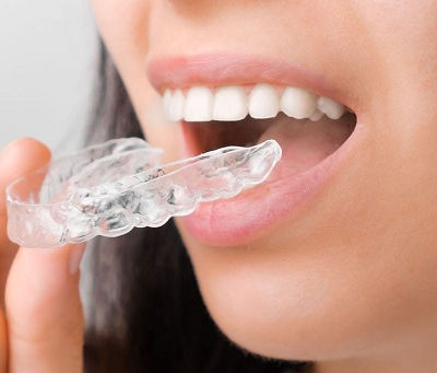 Exploring New Retainer Technology Available in Dubai