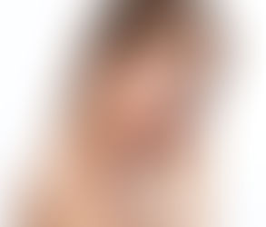 فهم تحديات الشفاء بعد جراحة تجميل الأنف