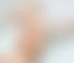 التقشير الكيميائي: دليل شامل لبشرة متوهجة