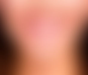 Digital Smile Design: Merging Art and Science in Dental Aesthetics