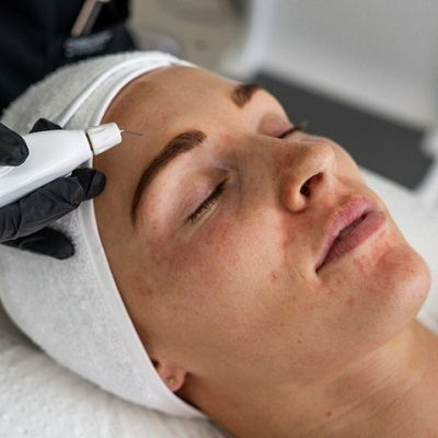 Plexr Plasma Eye Lift in Muscat