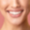Can You Whiten Dental Veneers?
