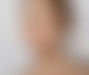 Who Can Benefit from Hyalift Injection? A Complete Guide
