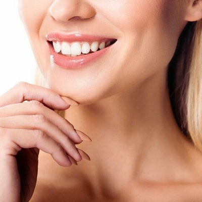 Teeth Whitening Cost in Dubai