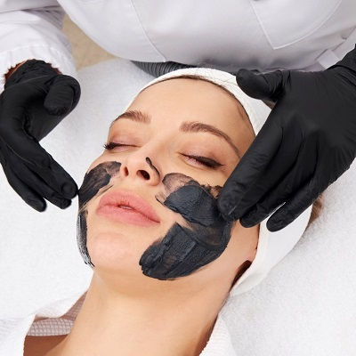 Best Laser Carbon Peel Muscat