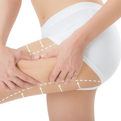 Thigh Lift Muscat