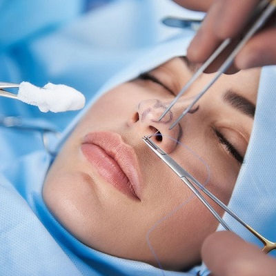 Septoplasty & Turbinate Reduction in Oma