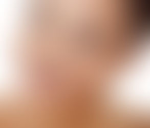 Orthodontists Share Braces Maintenance Do’s and Don’ts