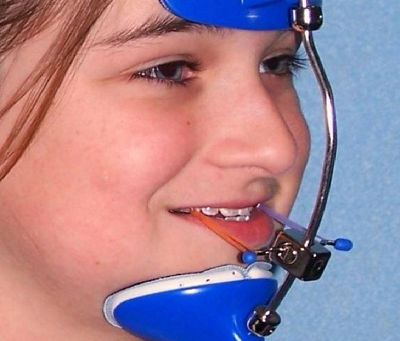 What Does Dental Headgear Do for Upper Jaw Issues?