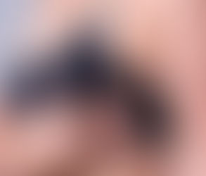 التعافي من عملية تصغير الثدي: نصائح للشفاء بشكل أسرع